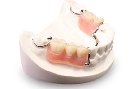 A removable partial denture (rpd) is for a partially edentulous dental patient who desires to have the reason why this type of prosthesis is referred to as a removable partial denture is because. Removable Cast Metal Elite Partial Denture Dds Lab