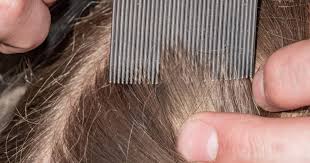 Image result for lice vs nits
