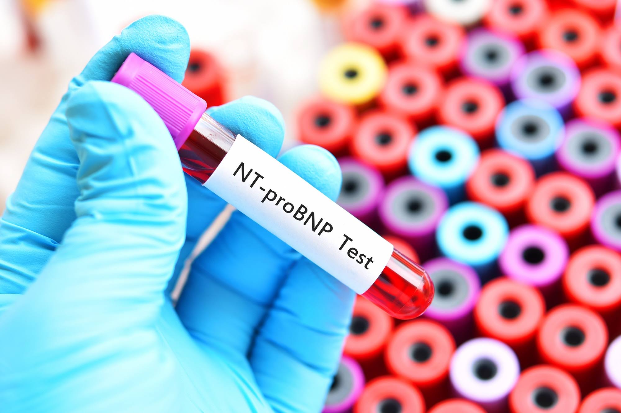 NT PRO BNP product image