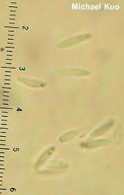 Image result for Chlorosplenium chlora