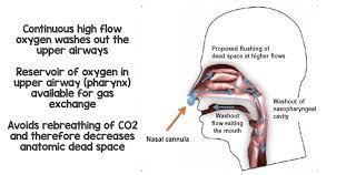 Standard oxygen therapy delivered through a nasal cannula or another . High Flow Nasal Cannula Hfnc Part 1 How It Works Rebel Em Emergency Medicine Blog