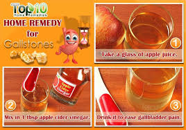 Juices should be home made and fresh not the store bought, store bought juices. Home Remedies For Gallstones Top 10 Home Remedies