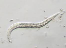 Der erreger kommt weltweit vor und löst die erkrankung oxyuriasis aus. Wurmer Im Stuhl Naturliche Behandlung Online Wurm Test