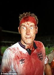 TIL during a game of Rugby, Shelford had his scrotum torn open and had one  testicle hanging out and just calmly walked off field to have his sack  stitched back together and