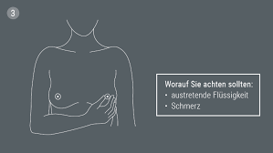 Brustkrebs Symptome Erkennen Und Richtig Deuten Focus Arztsuche