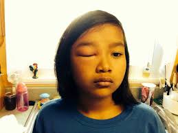 Julie's Musings: Something I Learned from a Bee Sting