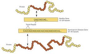 Huntington S Disease Wikipedia
