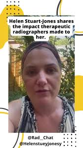 Thank you to Helen Stuart-Jones for sharing her experience of cancer  treatment and why people may consider a career as a  #therapeuticradiographer @healthsocialcarecareers
