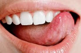 På det norske teatret blir werther et barn som drukner i utvendige påfunn. Tungen Gjor Vondt Og Svulmer Tungen Gjor Vondt Fra Siden Arsaker Og Behandling