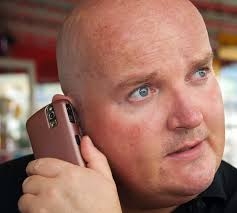 Hair loss is a relatively common occurrence that happens after gastric sleeve or gastric bypass surgery, no matter where in the world you have your surgery. Bariatric Surgery Gastric Sleeve Bypass Or Lap Band Prime Surgicare