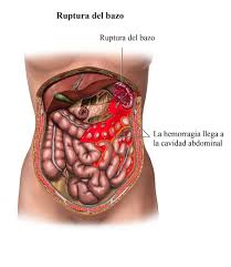 The word spleen comes from ancient greek σπλήν (splḗn). Dolor En El Bazo Causas Despues De Comer Sintomas Correr Inflamacion Y Tratamiento
