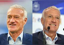Des dents parfaitement alignées et blanches, qui ont totalement fait oublier les la vraie raison pour laquelle didier deschamps a une nouvelle dentition. Avant Apres Les Transformations De Dents Des Stars Les Plus Spectaculaires