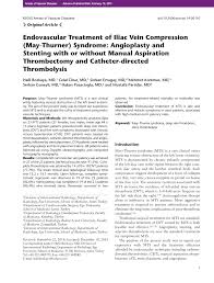Pdf Endovascular Treatment Of Iliac Vein Compression May Thurner Syndrome Angioplasty And Stenting With Or Without Manual Aspiration Thrombectomy And Catheter Directed Thrombolysis