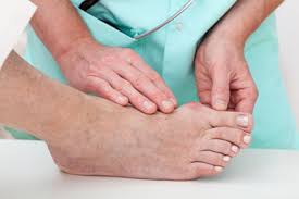 Will it slow the growth of the bunions and hammer toes? Yoga And Bunions