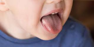 Check spelling or type a new query. Gejala Kanker Lidah Awalnya Mirip Sariawan Kenali Cirinya