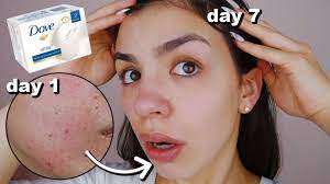 It made me comfortable enough to stay longer in the shower, not ever wanting to rinse it off. I Used Dove Soap On My Skin Everyday For One Week Youtube