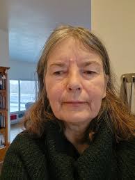 Hi there, new to the group. Also newly Diagnosed with MS at 43. Finding out  so many of my issues aren't from me being weird or were just normal, they  are actually