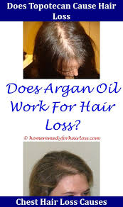 Patients undergoing spinal puncture or receiving anesthesia can be affected by a harmful spontaneous spinal epidural hematoma. Frontal Hair Loss Cat Hair Loss Hair Loss Shampoo Treat Hair Loss