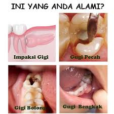 We did not find results for: Zentri Obat Sakit Gigi Berlubang Dan Gusi Bengkak Kemasan Baru Isi 10ml Shopee Indonesia
