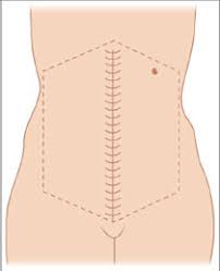 Kerr reservoir, also known as buggs island lake, was created with the construction of the john h. Jaypeedigital Ebook Reader