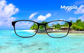 Image result for Refractive Error