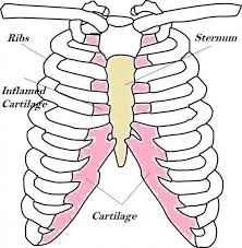Pin On Fibromyalgia Migraines And Thyroid Health