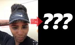 Tennis superstar serena williams has been laying low in france for the past month or so, and yesterday following a pic she posted, her face was going viral. Is Serena Williams Bleaching Skin Serena Williams Deletes Instagram Picture After Bleached Skin Accusations Go Viral Jordanthrilla