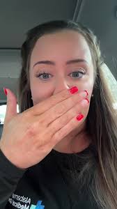 Transformación de labios: ¡mi primera vez con lip filler!