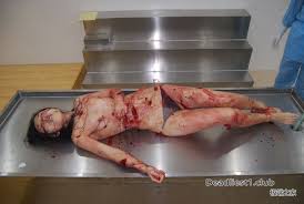 autopsy :: :: morbid :: xxx-files  funny cocks & best free porn: r34,  futanari, shemale, hentai, femdom and fandom porn