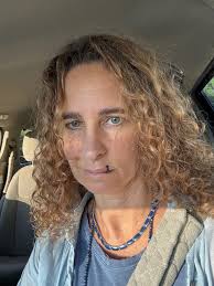 Dog Bite Injury and Recovery Discussion