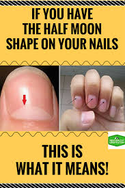 If You Have The Half Moon Shape On Your Nails This Is What It Means You Nailed It Health Natural Health