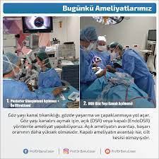 Goz Yasi Kanal Tikanikligi Gozde Yasarma Ve Capaklanmaya Yol Acar Goz Yasi Kanalini Acmak Icin Acik Dsr Veya Kapali Endodsr Yontemle Bilgi Kanal Gozler