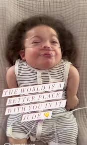 My world 💛 The world is certainly a better place with you in it, Jude. You  shine so bright! ✨ #JOYlikeJUDE #prayforjude #bravelittlewarrior  #HOPEforRCDP #HOPEisEVERYTHING #awareness #rhizowarrior ...