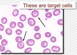 Film cell illustrations & vectors. Codocyte Red Blood Cell Blood Film Poikilocytosis Cavernous Cell Purple Violet Png Pngegg