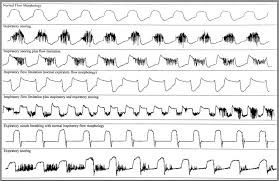 do mask leaks affect flow limitation cpaptalk com