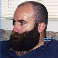 Dennis: the truly outstanding beard