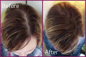Pcos hair loss occurs as a direct result of hormonal imbalances. The Secret To Thicker Fuller Looking Hair Pcos Diva Regrow Hair Naturally Regrow Hair Women Regrow Lost Hair