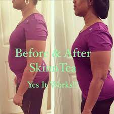 Pin On Health And Wellness