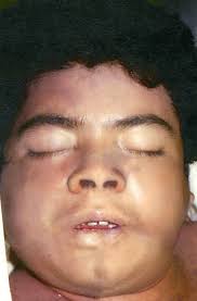 IDENTIFIED: John D. Coats Sr (1882-1961) Source= Findagrave