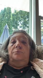 Labor day weekend trip cut short due to accident