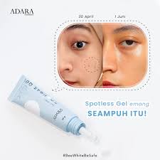 Apa iya guys Bee White Spotless Gel seampuh itu??? 🤔 Pastinya iya dong!  Spotless Gel memang seampuh itu 🤩 Dengan kandungan Bee Venom, Niacinamide,  Vitamin C, Rosehip Oil, dan Ceramide, Bee White
