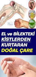 el ve bilekteki kistlerden kurtulmanin caresi health