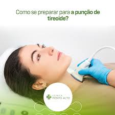 Punção de tireoide: o que fazer antes e depois do procedimento? - Ponto Alto