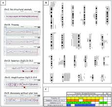 Maybe you would like to learn more about one of these? Trisomy 19 Ependymoma A Newly Recognized Genetico Histological Association Including Clear Cell Ependymoma Molecular Cancer Full Text