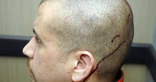 It is our system working as intended. Trayvon Martin Shooting New Evidence Shows Wounds On Zimmerman S Head Thc Found In Martin S Body Cbs News