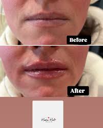 Nurse Nel Aesthetics