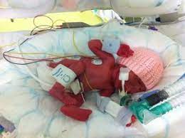 Bebeginiz Kor Kalmasin Rop Muayenesi Cok Onemli Nicu Bebek Bebek Ikizler