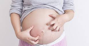 Tetapi anda perlu tahu, keadaan perut mengeras semasa hamil juga boleh berlaku bermula pada trimester pertama. Penyebab Perut Keras Saat Hamil Popmama Com