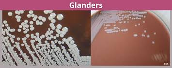 Image result for Glanders