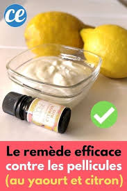 Le Remede Naturel Contre Les Pellicules Que Vos Cheveux Vont Adorer Astuces Contre Les Pellicules Shampoing Anti Pelliculaire Remede Pellicule